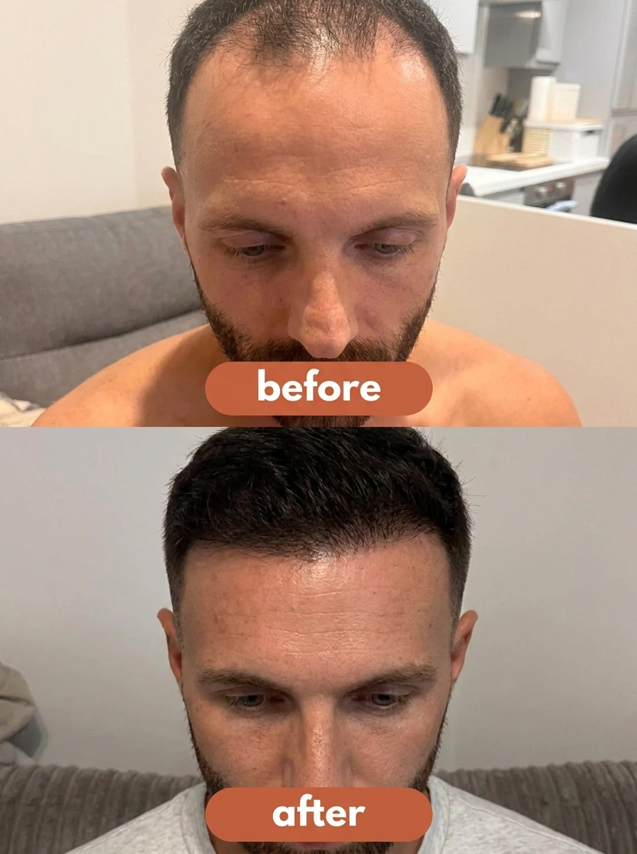 ThickenLabs Advanced Hair Density Roll-On Serum